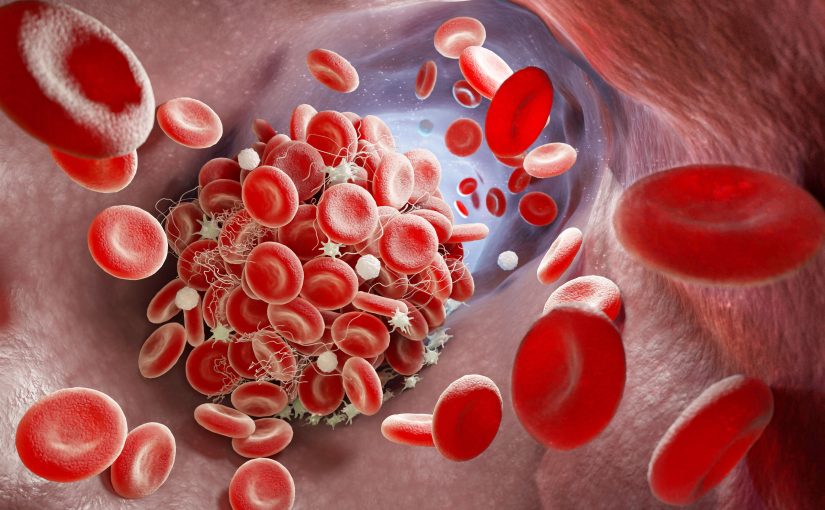 Optical Method-Derived Clot Curve: Introduction and Basic Applications (Open For Registration)